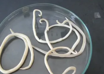 Cacing Gelang Menginfeksi Anak di Sukabumi dengan Panjang Hingga 35 Cm