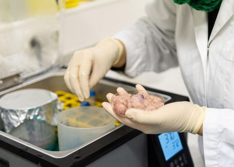 Donor Organ dalam Perspektif Islam Apakah Diperbolehkan?