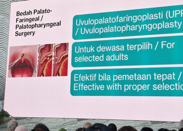 Mendengkur Bukan Tanda Tidur Nyenyak Menurut Dokter