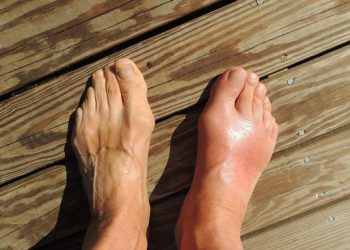 Makanan Tak Terduga Ini Dapat Meningkatkan Asam Urat