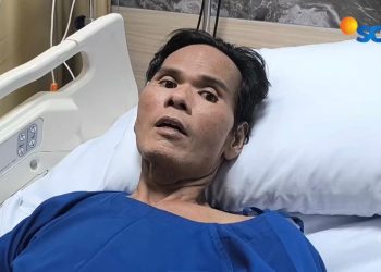 Fahmi Bo Ceritakan Kondisi Terkini Usai Operasi Batu Empedu