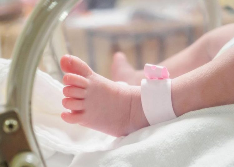 Dokter Aceh Temukan Kasus Langka Bayi Bergunting Sepuluh Jari di Kaki Kiri