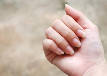 Cara Mengenali Kuku Tidak Sehat Sebagai Sinyal Tanda Penyakit